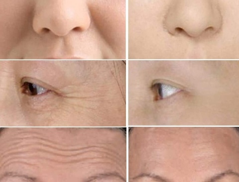 Masażer ROLLER 3D Wibracyjny do twarzy ciała lifting przeciwzmarszczkowy ujędrnienie